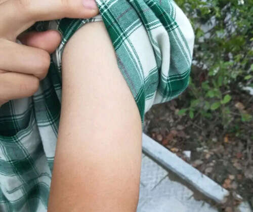 如何让皮肤变得细嫩白皙?皮肤美白小技巧