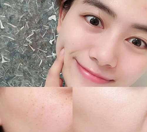 面部长色斑怎么办?要明白面部色斑形成的原因