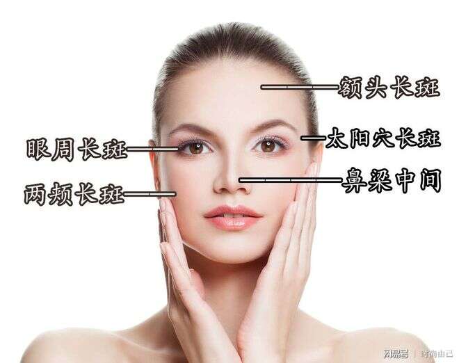 脸部各种色斑形成的原因是什么?如何美白淡斑预防皮肤长斑呢?