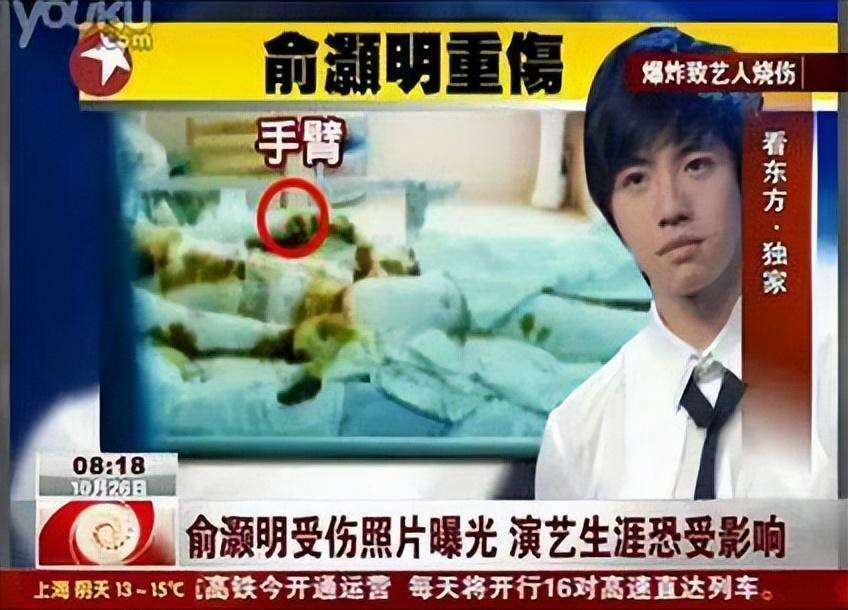 俞灏明23岁毁容、被公司放弃、好友背叛,他蛰伏五年,如今成了人生赢家