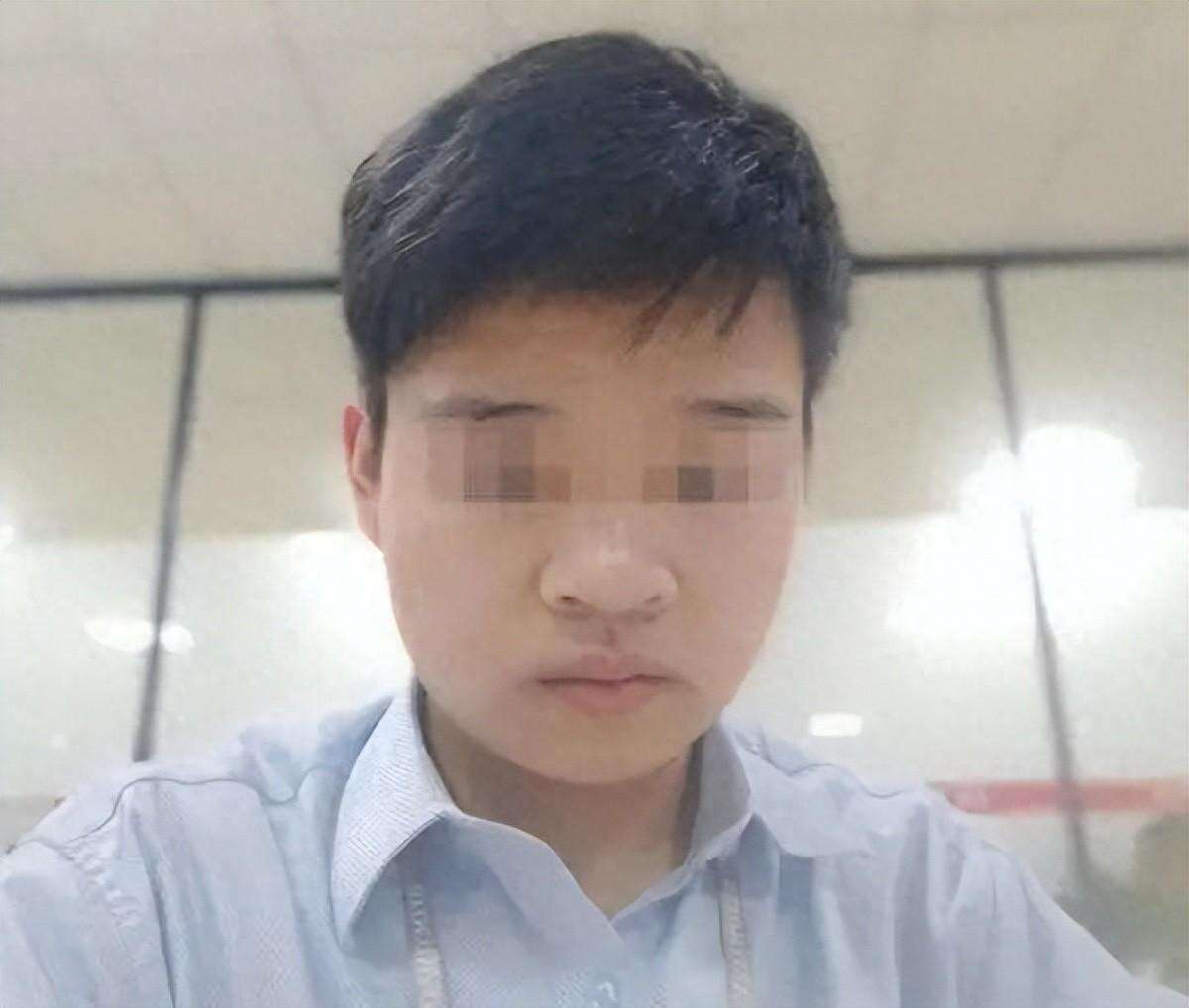 小伙拔智齿后晕倒,开颅手术14天后去世!网友担心:还能拔吗?